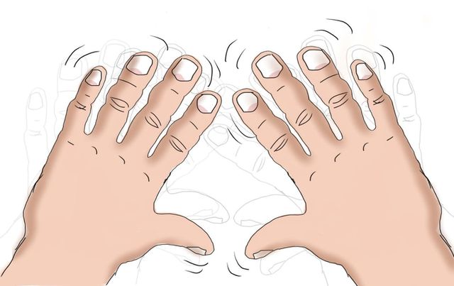 Run vô căn - Hình ảnh minh họa